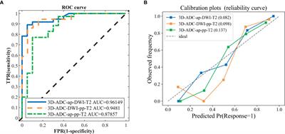 Differentiating TP53 Mutation Status in Pancreatic Ductal Adenocarcinoma Using Multiparametric MRI-Derived Radiomics